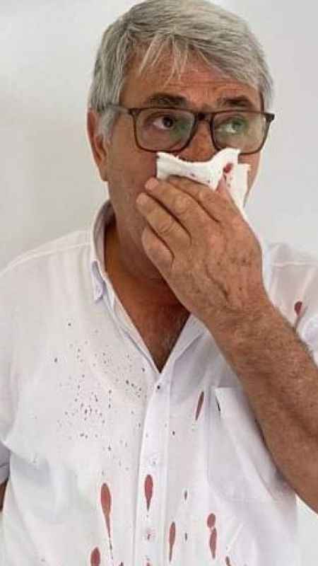 CHP’li Belediye Başkan Yardımcısı’ndan muhtara dayak CHP’li Belediye Başkan Yardımcısı’ndan muhtara dayak