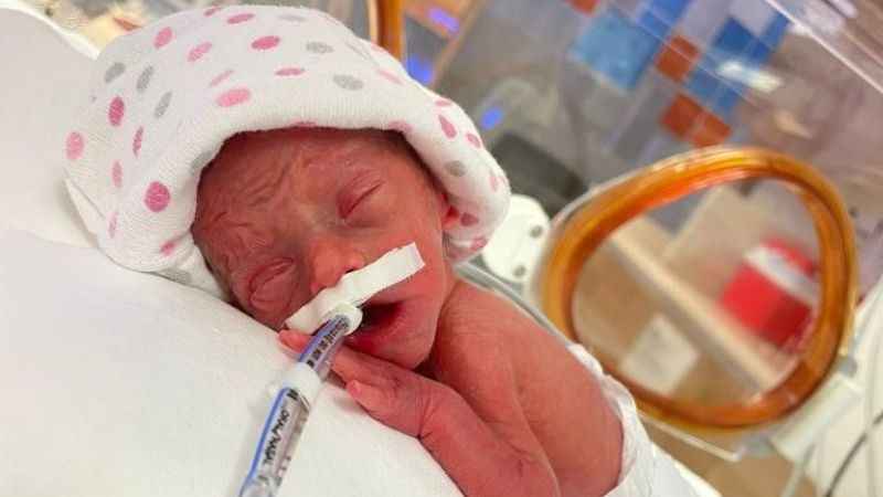 500 gram doğmuştu, 90 gün sonra sağlığına kavuştu 500 gram doğmuştu, 90 gün sonra sağlığına kavuştu