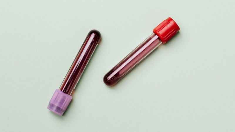 Sağlıklı hücreler için düzenli kan bağışı yapın Sağlıklı hücreler için düzenli kan bağışı yapın