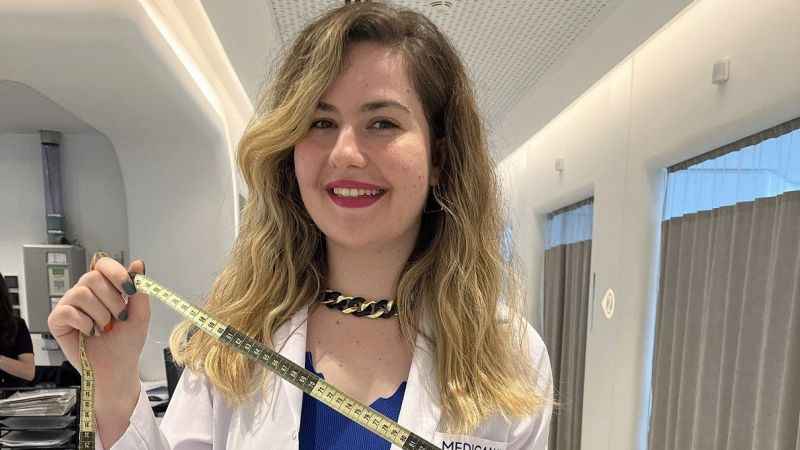 Obezite ameliyatı sonrası doğru beslenme şart Obezite ameliyatı sonrası doğru beslenme şart