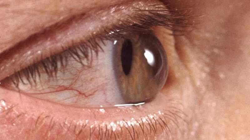 Sonbaharda göz sağlığını korumak için bunlara dikkat! Sonbaharda göz sağlığını korumak için bunlara dikkat!