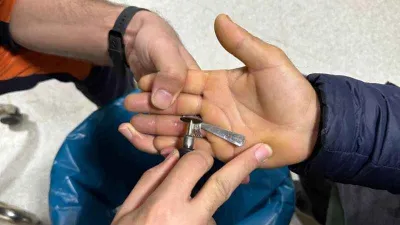 Parmağına yüzük sıkıştı, yardımına itfaiye koştu